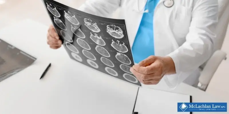 Hermosa Beach Brain Injury Lawyer Best Hermosa Beach Brain Injury Lawyer